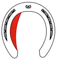 Werkman-Orthokit-Eins, Schenkelverbreiterung (1 St.) 