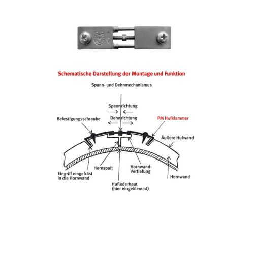 Artikelbild des Artikels “PM-Hornspaltklammer REG, verstellbar (St.) “