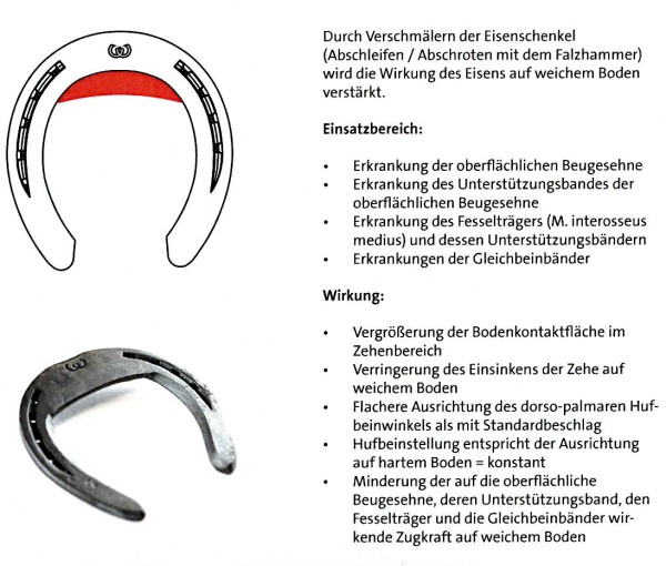 Artikelbild 3 des Artikels “Werkman-Orthokit-Eins, Zehenverbreiterung (1 St.) “